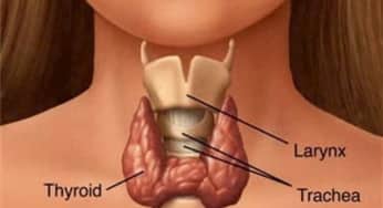 Phân loại các thể u tuyến giáp và phương pháp điều trị