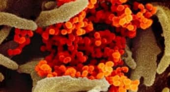 Phát hiện một protein “phản loạn” trong cơ thể, kẻ mở cổng thành đón corona virus (SARS-CoV-2) vào tế bào