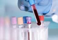 Phát hiện sớm 5 bệnh ung thư qua phương pháp xét nghiệm máu mới