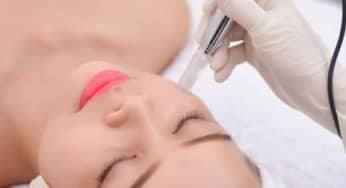 Phi kim trị sẹo thâm, sẹo rỗ: Quy trình, tác dụng và chăm sóc