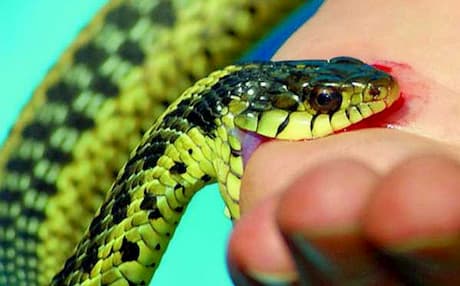 Rắn độc cắn: biểu hiện, xác định loại rắn độc, xử trí cấp cứu