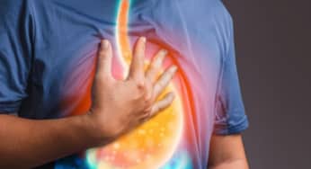 SIBO có gây ra GERD hay không? SIBO và bệnh trào ngược dạ dày thực quản có liên quan như thế nào
