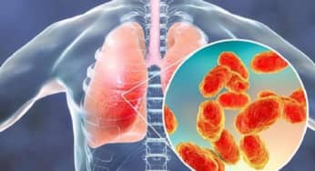 Sự khác nhau giữa viêm phổi tiên phát do cúm B và viêm phổi thông thường