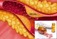 Bệnh mỡ máu cao, gan nhiễm mỡ tăng nhanh ở người trẻ