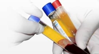 Thử nghiệm lâm sàng điều trị corona virus – covid-19 bằng huyết tương người đã khỏi