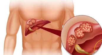 <strong>Thực trạng bệnh viêm gan tại Việt Nam – Nguyên nhân và giải pháp</strong>