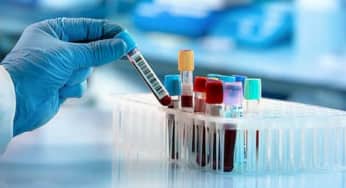 Tìm hiểu về phương pháp xét nghiệm máu tìm dấu ấn ung thư