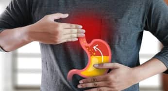 Trào ngược dạ dày thực quản (GERD): triệu chứng, nguyên nhân, biến chứng