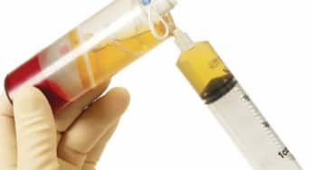 Ưu nhược điểm của huyết thanh và huyết tương trong xét nghiệm sinh hóa và miễn dịch