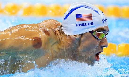 Vận động viên Mỹ dự Olympic chữa bệnh bằng giác hơi