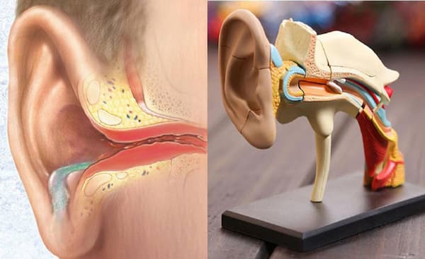 Viêm tai giữa cấp tính Nguyên nhân, triệu chứng, điều trị