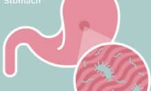 Đơn giản hóa việc chẩn đoán H. pylori bằng xét nghiệm dễ dàng tại nhà