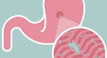 Đơn giản hóa việc chẩn đoán H. pylori bằng xét nghiệm dễ dàng tại nhà